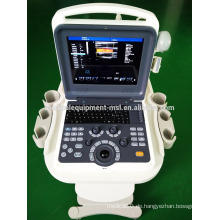 2015 Super Qualität ipad Ultraschall-Scanner, 4d Ultraschall-Maschine mit CE-Zertifikat